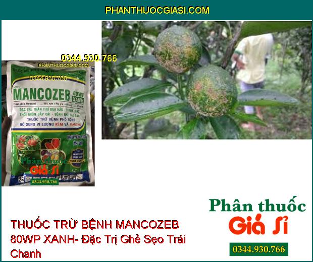 THUỐC TRỪ BỆNH MANCOZEB 80WP XANH- Đặc Trị Thán Thư- Thối Nhũn- Ghẻ Sẹo- Bổ Sung Vi Lượng