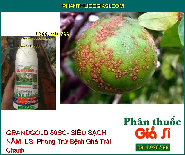 THUỐC TRỪ BỆNH GRANDGOLD 80SC- SIÊU SẠCH NẤM- LS- Phòng Trừ Các Bệnh Do Nấm Gây Ra