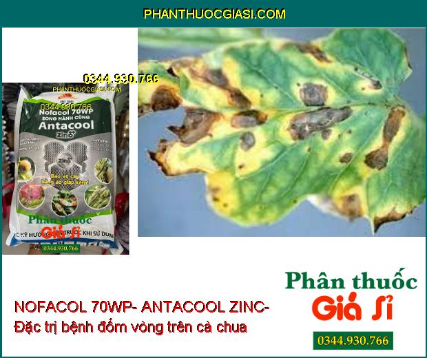 NOFACOL 70WP- ANTACOOL ZINC