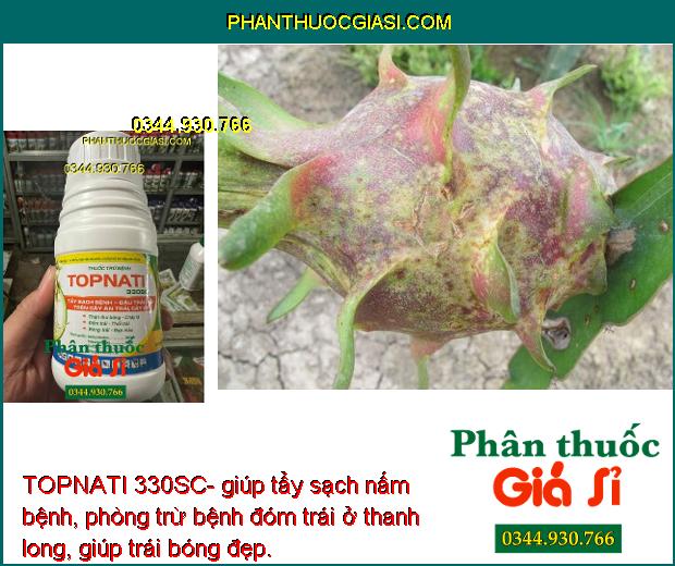 TOPNATI 330SC- Tẩy Sạch Nấm Bệnh - Đặc Trị Thán Thư - Đốm Lá - Thối Trái